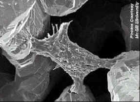 SEM micrograph of mouse monocyte-macrophages cultured at 37C, 100% humidity, 5% CO2 in RPMI medium (5%SFB, 1% streptomycin-penicillin)
