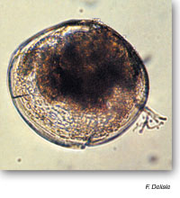 The Umbonal stage of a Zebra Mussel larva.